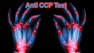 AntiCCP antibodies Anticitrullinated peptide antibodies  test  what does it mean [upl. by Eenal]