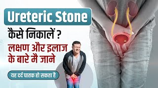 Ureteric Stone in Hindi  Symptoms ManagementTreatment Pain xrays  Ureteric Stone kaise nikale [upl. by Nameloc]