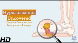 Hyperuricemia Understanding Its Signs Effects amp Management Essentials [upl. by Sheets]