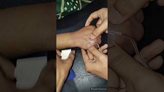 How to place a scalp vein set to give intravenous fluid  complete step by step procedure procedure [upl. by Reisinger]