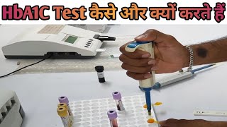 HbA1C test full procedure HbA1C टेस्ट कैसे और क्यों करते हैं LabtechGurukundanSingh [upl. by Asilram]