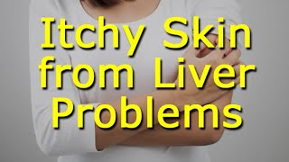 Itchy Skin from Liver Problems [upl. by Ettelohcin634]