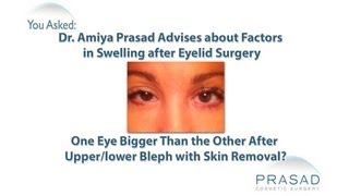 Factors in the Healing Process that Cause Temporary Swelling after Eyelid Surgery [upl. by Thilda330]