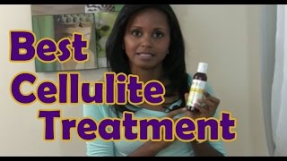 Best Cellulite Treatment  Jovanka Ciares [upl. by Siraf]