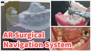 Advanced Surgical Navigation System using Augmented Reality Technology [upl. by Ainehs]