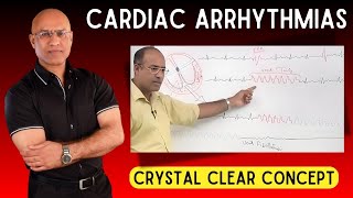 Cardiac Arrhythmias  Tachycardia and Bradycardia  Cardiology [upl. by Yemorej]