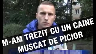 Mam trezit cu un câine muşcat de piciorul drept I [upl. by Osnohpla]