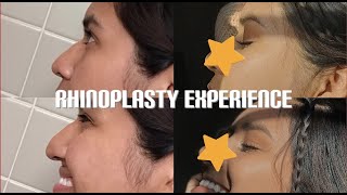 My Rhinoplasty Experience in Mexico City 🇲🇽 recovery vlog cost doctor etc [upl. by Josiah28]