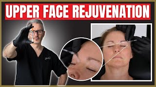 Upper Face Injection techniques  Botox amp Filler Periorbital Rejuvenation Tutorial [upl. by Hernandez]