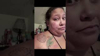 Brachioplasty and breast implant removal week 12 healing surgeryrecovery [upl. by Llerahc240]