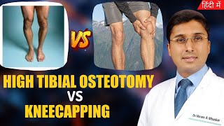 Difference Between High Tibial Osteotomy Vs Kneecapping  Hindi  Partial Knee Replacement Surgery [upl. by Trotta]