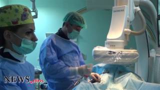 Uterine fibroids embolization Эмболизация маточных артерий [upl. by Reinert191]