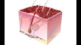 Lutronic Laser  碳粉激光 Spectra Peel [upl. by Aisatnaf]