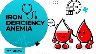 Iron deficiency anemiairon deficiency anemia treatmentanemia notesiron deficiency anemia symptoms [upl. by Nnyluqcaj]