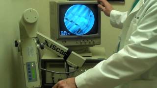 Fluoroscopy [upl. by Tap]