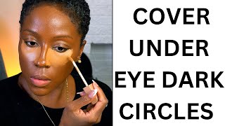 How to Hide Dark Circles Under Eyes With Makeup [upl. by Ehtyde]