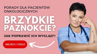 PAZNOKIEĆ Oderwany od Skóry Onycholiza w Chorobie Nowotworowej  Jak Leczyć [upl. by Rep]