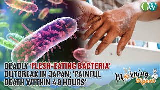 DEADLY ‘FLESHEATING BACTERIA’ OUTBREAK IN JAPAN PAINFUL DEATH WITHIN 48 HOURS [upl. by Marienthal]