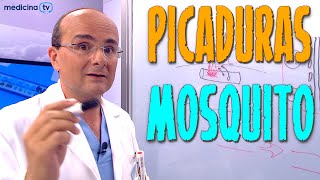 PICADURA DE MOSQUITO ¿Cómo es ¿Qué síntomas producen ¿Cómo hay que actuar ¿Cómo Prevenirlas [upl. by Oiralednac]