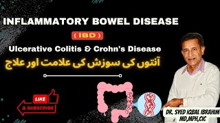 Inflammatory Bowel Disease IBD Ulcerative Colitis amp Crohn’s Disease [upl. by Etezzil]