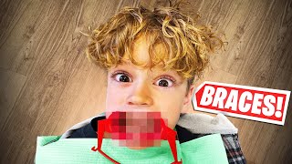 9 YEAR OLD GETTING BRACES ROWDYROGAN [upl. by Adli]