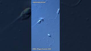 Human Sperm under the Microscope shorts [upl. by Ydospahr365]