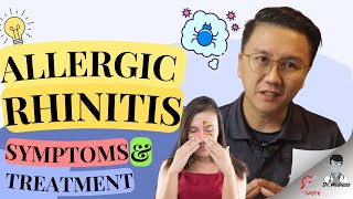 Allergic Rhinitis Symptoms and Treatment Explained [upl. by Plossl]