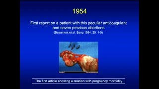 Antiphospholipid syndrome [upl. by Eyahsal]