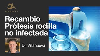 Recambio de Prótesis de Rodilla no Infectada [upl. by Enenaj385]