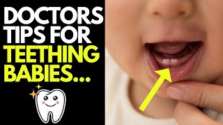 Doctor explains key things you need to know about BABY TEETHING  Symptoms amp tips for managing it [upl. by Virgie496]