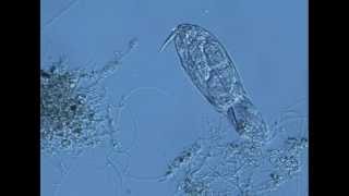 rotifer ingesting filamentous bacteria in activated sludgem1v [upl. by Frechette]