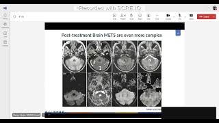 Standardized and Advanced Reporting in Brain Tumor Imaging  Mariam Aboian MDPhD [upl. by Yarod]