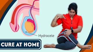 इन योग से ठीक होगा हाइड्रोसील घर बैठे  Best YOGA POSES to CURE Hydrocele at Home FAST  Yogawale [upl. by Kielty]