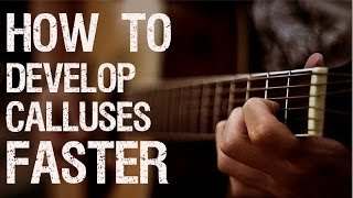 Simple Tricks to Develop Calluses Faster for quotGuitar Playingquot quotEasy Guitar Lessonsquot [upl. by Nawuq]