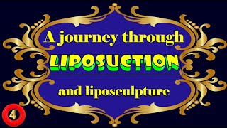 A journey through liposuction and liposculpture Part 410 [upl. by Yann]