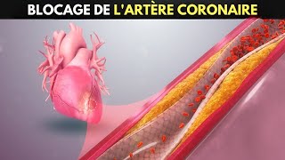 Maladie coronarienne  Causes symptômes et préventions [upl. by Garlaand]