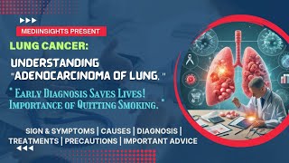 Understanding Adenocarcinoma of Lung Symptoms Causes Diagnosis and Treatments  MediInsights [upl. by Vera]