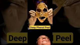 क्या Deep Phenol Peel Safe है phenolpeel chemicalpeel skinpeel shorts DMC [upl. by Olaf]