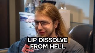 Lip Filler Dissolve Gone Wrong 😱  OKAY REALLY [upl. by Hentrich]