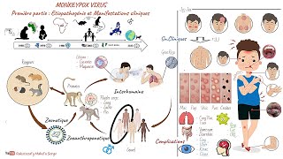 Monkeypox Virus MPox  Première partie  Etiopathogénie et Manifestations cliniques [upl. by Oniluap270]