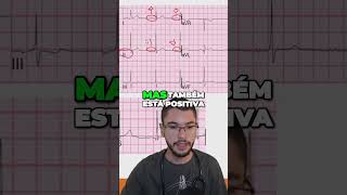 COMO AVALIAR O RITMO SINUSAL NO ECG enfermagemtotal educacaomedica [upl. by Antonella]