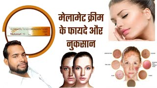 Melamet cream  Melamet cream uses in Hindi  Melamet cream ke fayde  दाग धब्बों के लिए [upl. by Cinelli231]