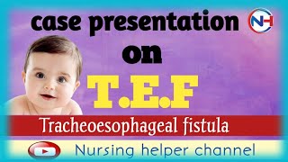 case presentation on TEFcase file on tracheoesophageal fistulapediatric file on TEFTEFtef [upl. by Anoed982]