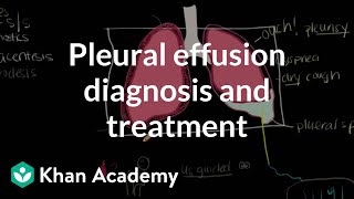 Pleural effusion diagnosis and treatment  Respiratory system diseases  NCLEXRN  Khan Academy [upl. by Berenice]