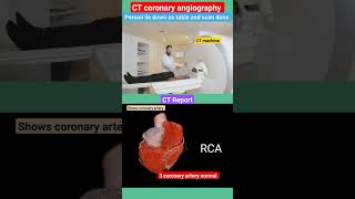 CT coronary angiography l heart coronaryartery shorts [upl. by Ayotahc318]