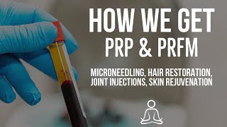 How to get PRPPlatelet Rich Plasma amp PRFMPlatelet Rich Fibrin MatrixMicroneedling amp Injections [upl. by Noiraa]