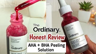 The ordinary AHA BHA Peeling Solution Review FACIAL IN A BOTTLE [upl. by Muller]