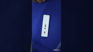 Malaria test in emergency ward emergency duty hospital nursing doctor subscribe mbbs [upl. by Gordan131]