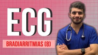 ELECTROCARDIOGRAMA  Bradiarritmias 8 EXPLICADO FÁCIL [upl. by Sorvats]