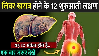 लिवर खराब होने में 12 शुरुआती लक्षण  12 Weird Signs Of Liver Damage  Liver Damage Signs In Hindi [upl. by Elaine]